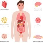 aspectos psicologicos en el tratamiento del sindrome de cushing