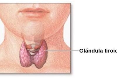 cambios glandulares en el cuerpo durante la menopausia