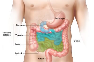 cancer neuroendocrino y su relacion con enfermedades asociadas