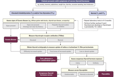 causas comunes de tirotoxicosis hipertiroidismo y otros factores