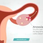 ciclos anovulatorios definicion y caracteristicas esenciales