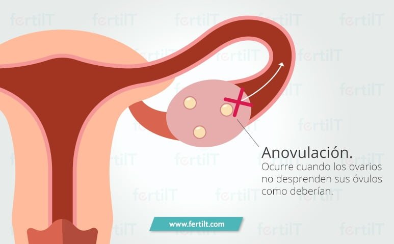 Ciclos anovulatorios: definición y características esenciales 1 ciclos anovulatorios definicion y caracteristicas esenciales