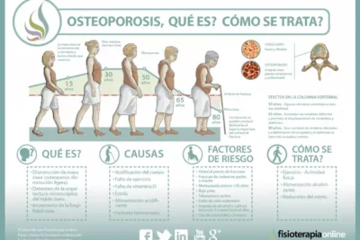 clasificacion causas y tratamientos de la osteoporosis