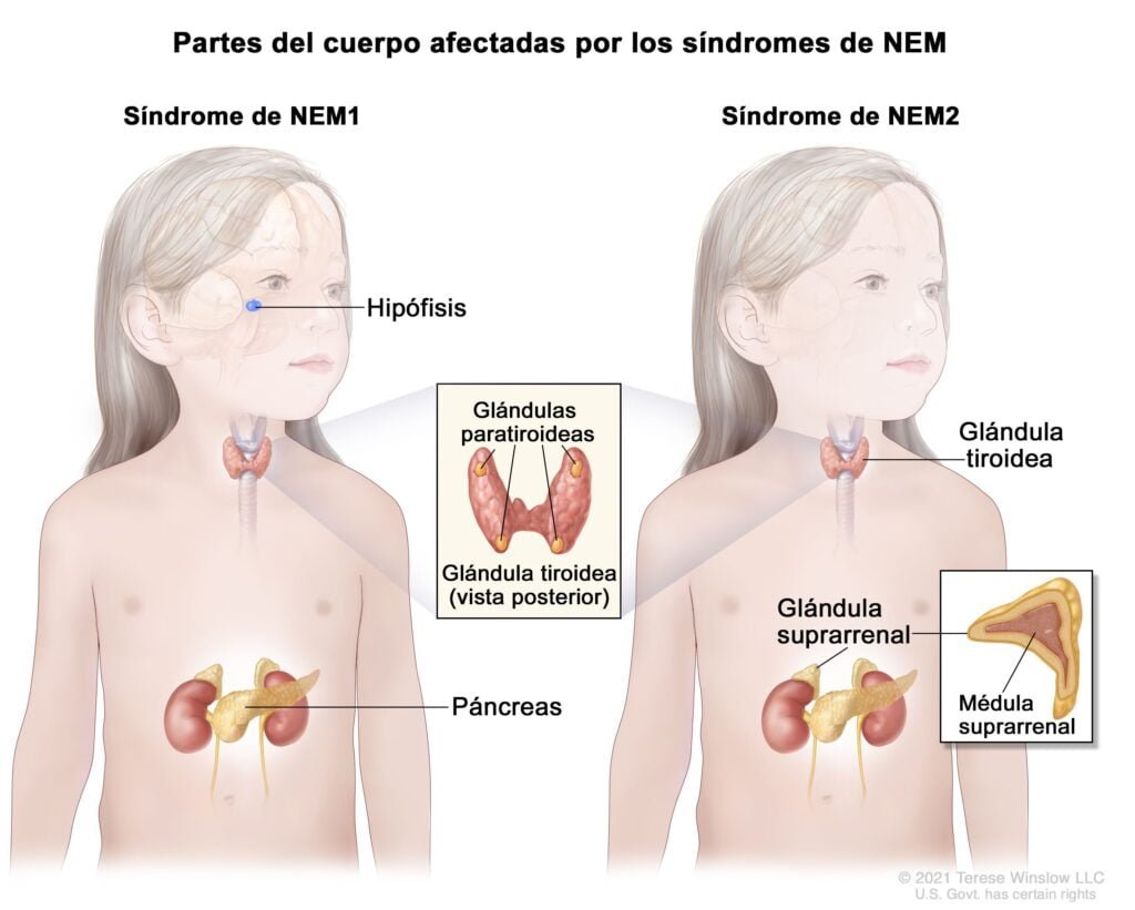 como afecta la edad a los trastornos neuroendocrinos
