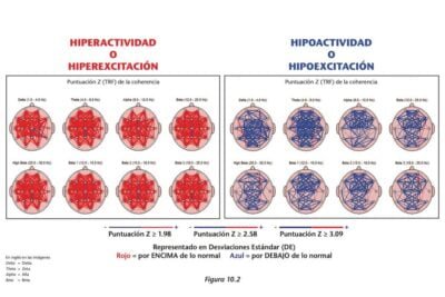 como afecta la hipoactividad a los niveles de energia