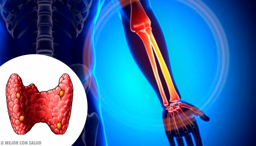 Cómo afecta la hormona paratiroidea a la salud ósea 1 como afecta la hormona paratiroidea a la salud osea