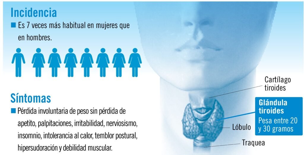 como afecta la tirotoxicosis a la salud mental