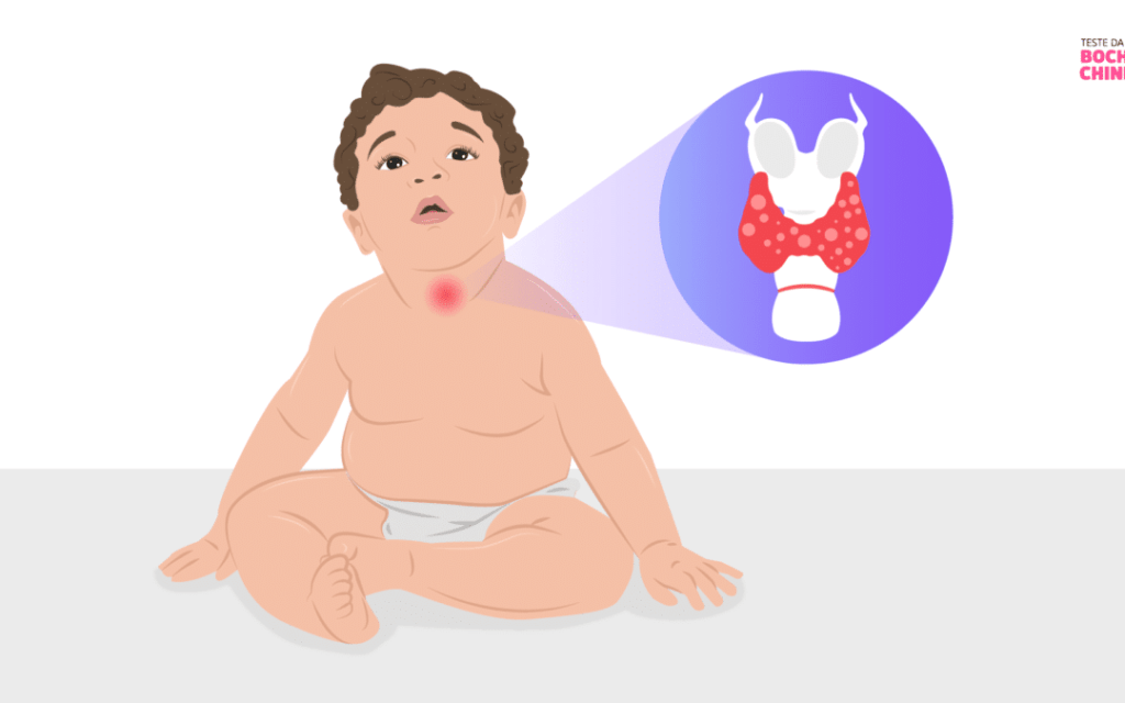 como influye la genetica en enfermedades glandulares