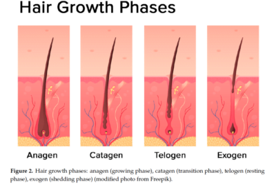 como influyen las hormonas en el crecimiento del cabello