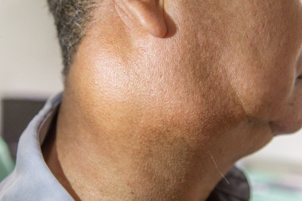 Cómo interfiere el tabaco en la salud glandular 1 como interfiere el tabaco en la salud glandular