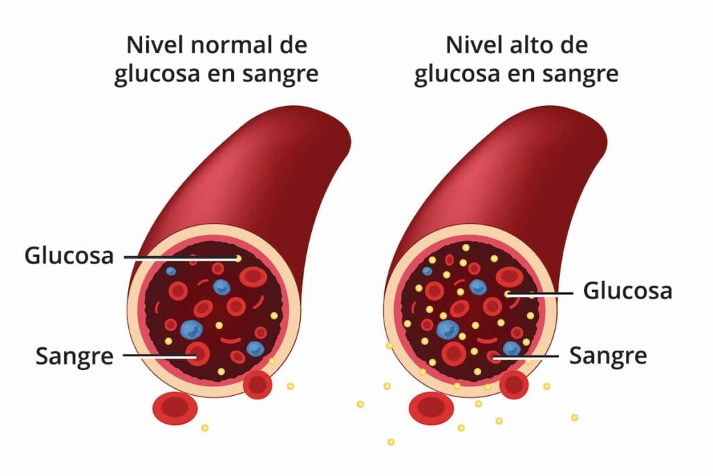 como la insulina influye en el desarrollo y control de la diabetes