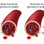 Cómo la insulina influye en el desarrollo y control de la diabetes