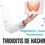 como se debe manejar un diagnostico de tiroiditis