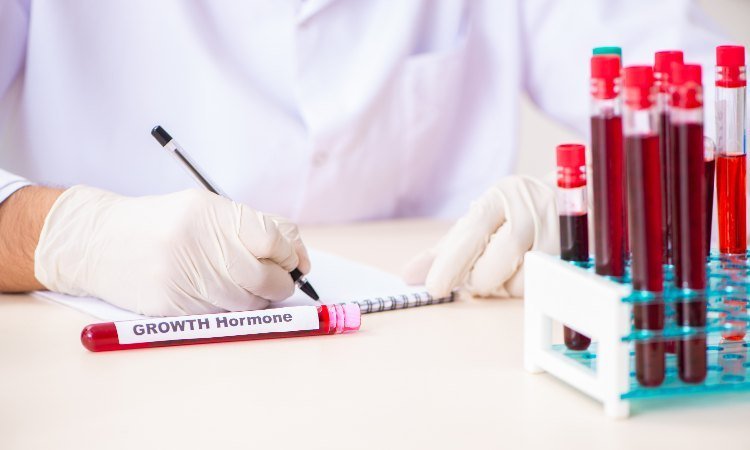 Cómo se deben interpretar los análisis hormonales 1 como se deben interpretar los analisis hormonales