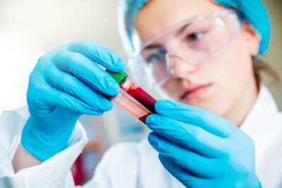 como se diagnostican los trastornos endocrinos