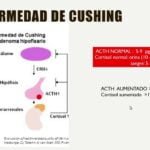 como se educa al paciente sobre el sindrome de cushing