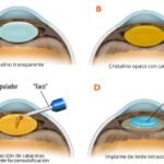 como se relaciona el eje hormonal con la salud ocular