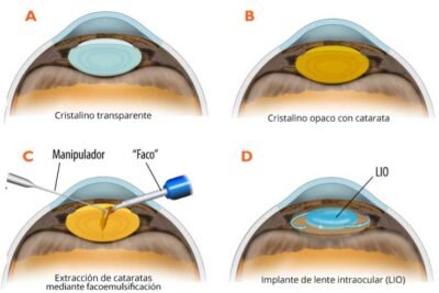 como se relaciona el eje hormonal con la salud ocular
