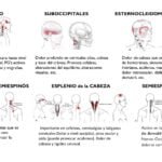 Cómo se relacionan la hipoglucemia y las migrañas