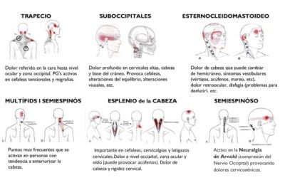 como se relacionan la hipoglucemia y las migranas