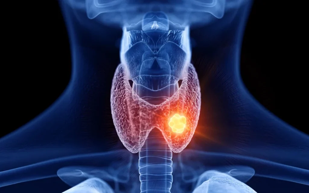 Cómo se relacionan las hormonas peptídicas y la tiroides 1 como se relacionan las hormonas peptidicas y la tiroides