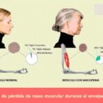 Cómo se relacionan los andrógenos con el envejecimiento