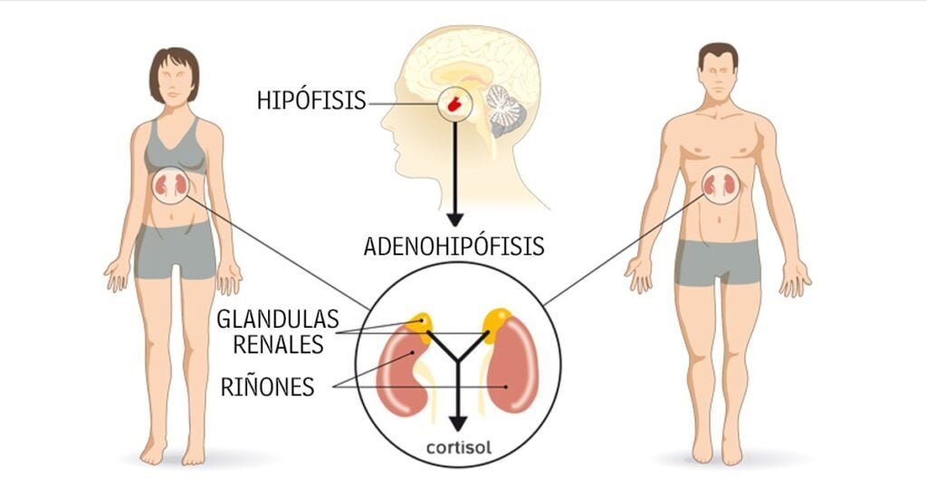 como se trata el sindrome de cushing con medicamentos