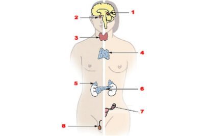 como son los estudios de casos en neuroendocrinologia