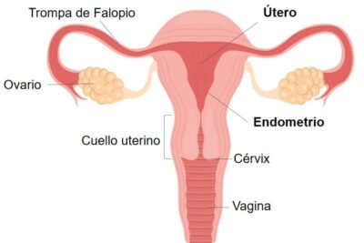 conexion entre estrogenos y cancer endometrial cual es