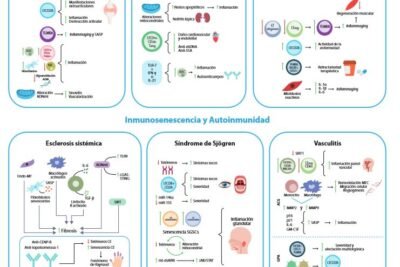 control multidisciplinario de enfermedades autoinmunes como hacerlo