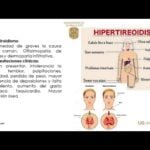 crisis tiroidea sintomas esenciales que debes conocer