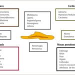 cual es la diferencia entre hipoactividad y astenia