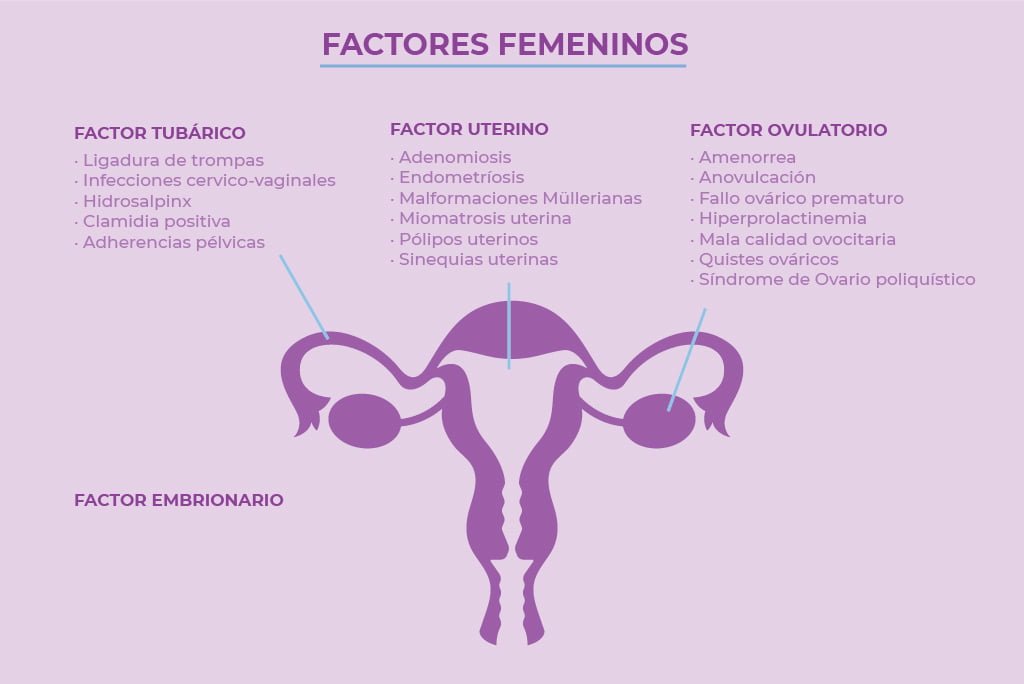 cuales son las causas de la infertilidad en mujeres