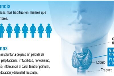 Cuáles son los signos de problemas tiroideos en hombres 1 cuales son los signos de problemas tiroideos en hombres