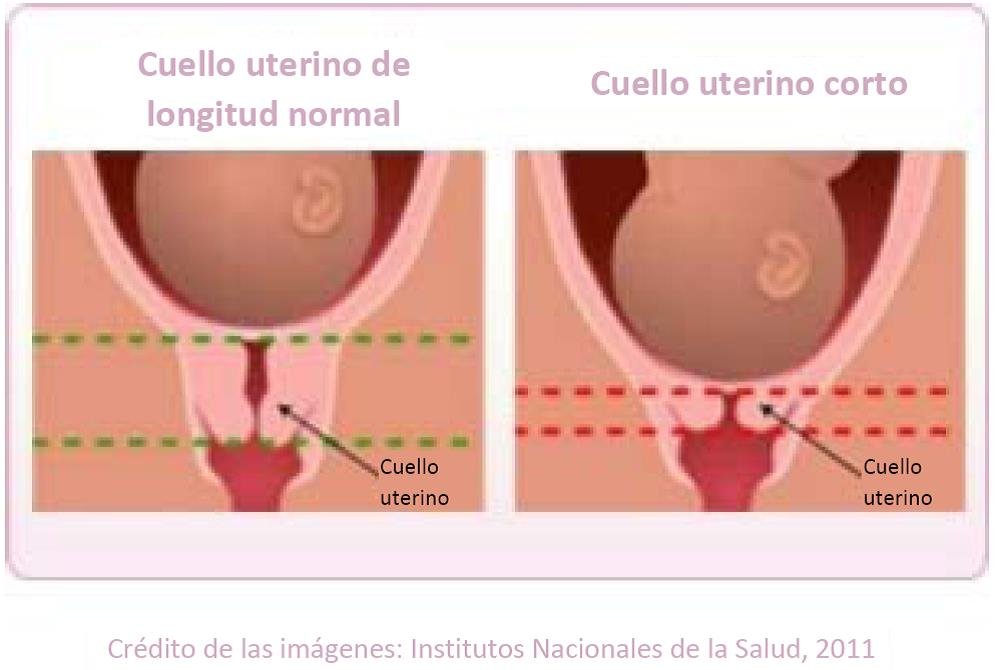 cuando se recomienda la terapia de progesterona