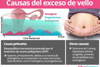 desequilibrio hormonal y su relacion con los androgenos