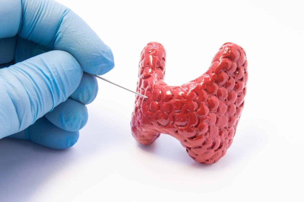 diagnostico del carcinoma de tiroides pruebas y procedimientos clave