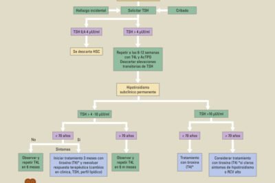 diagnostico del hipotiroidismo sintomas y pruebas clave