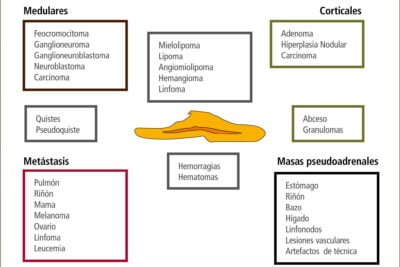 diagnostico diferencial en problemas glandulares establecido