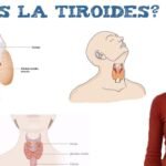 diferencias entre hipotiroidismo e hipertiroidismo explicadas