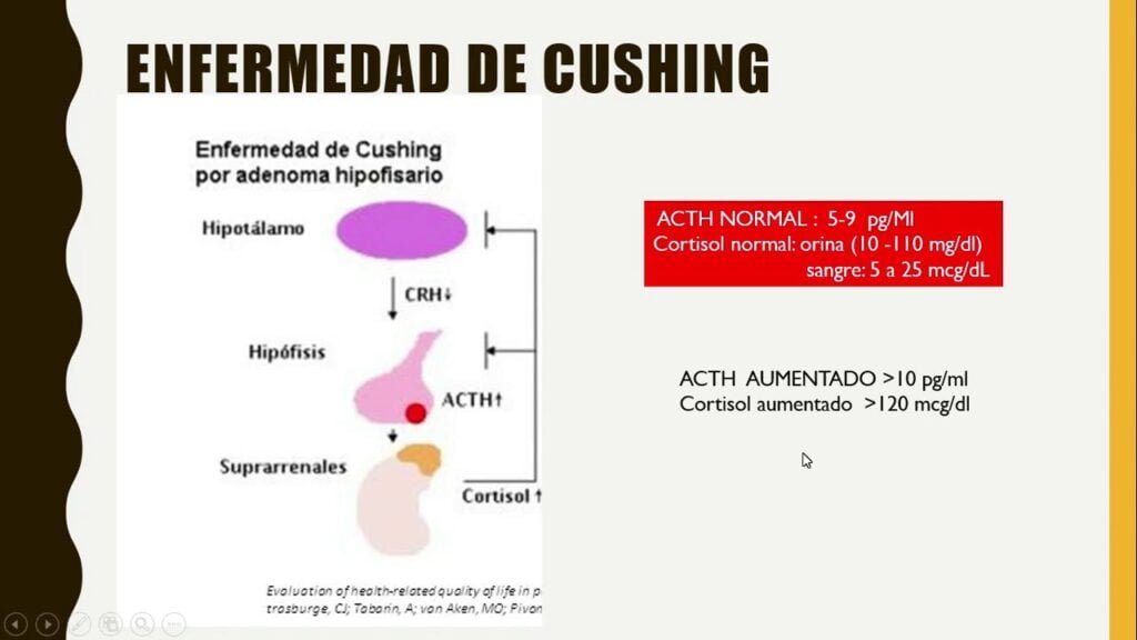 Diferencias entre síndrome y enfermedad de Cushing: guía completa 1 diferencias entre sindrome y enfermedad de cushing guia completa
