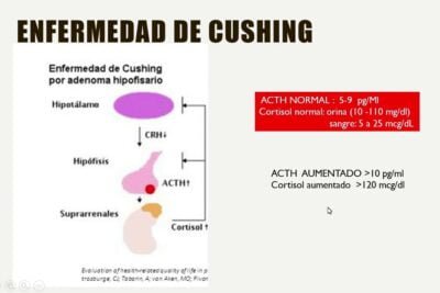 diferencias entre sindrome y enfermedad de cushing guia completa