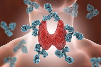 efectos del hipotiroidismo en el equilibrio hormonal del cuerpo