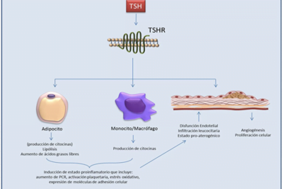 el estres y la tirotoxicosis analisis de su conexion