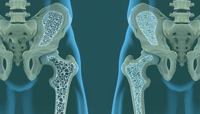 el papel de los estrogenos en la salud osea y la osteoporosis