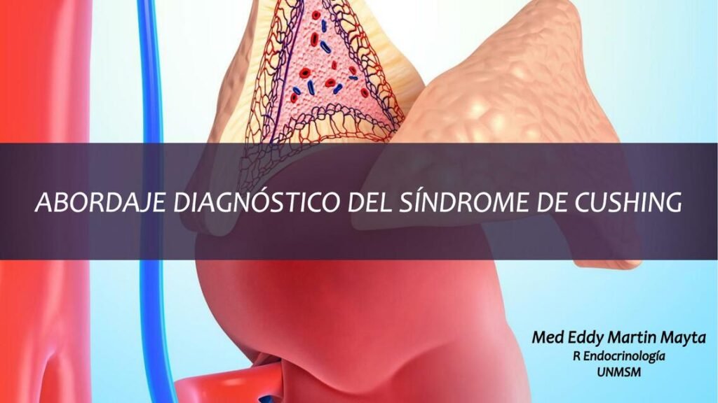 endocrinologos y su rol en el manejo del sindrome de cushing
