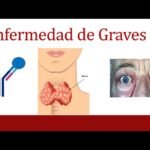 enfermedad de graves sintomas y tratamientos que debes conocer