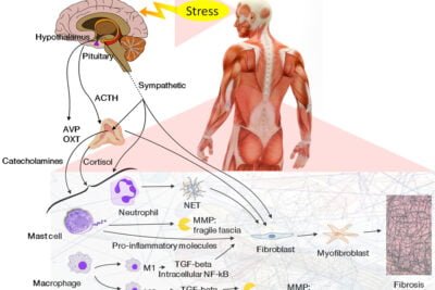 estimulacion por estrogenos en tumores neuroendocrinos que es