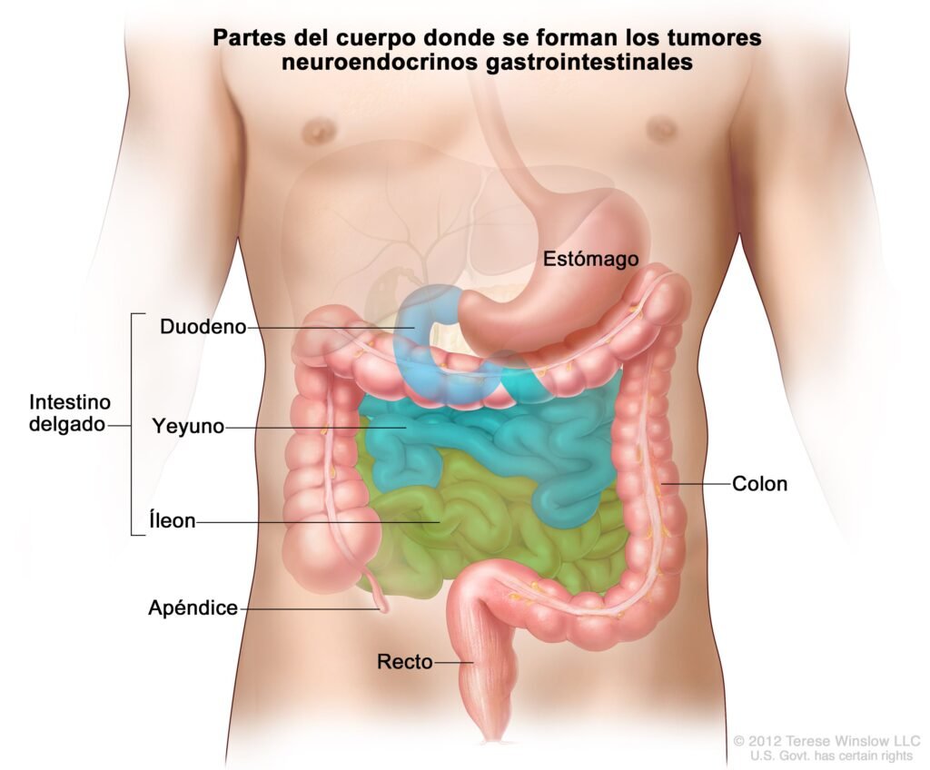 evaluacion de sintomas gastrointestinales en tumores neuroendocrinos