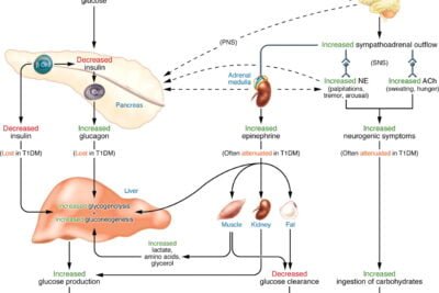 explicacion sencilla y clara de la hipoglucemia a un amigo